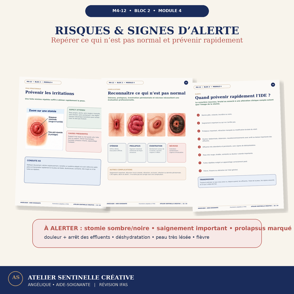 Aperçu 7 — M4-12 — Soins et dispositifs urologiques et digestifs