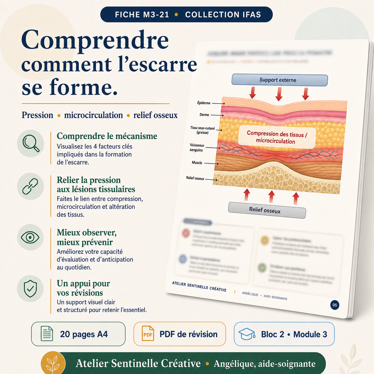 Page « Comprendre comment l’escarre se forme » avec schéma de pression des tissus.